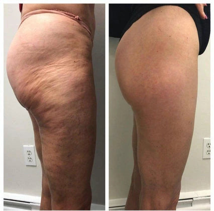 Valérie, 49 ans, Lyon